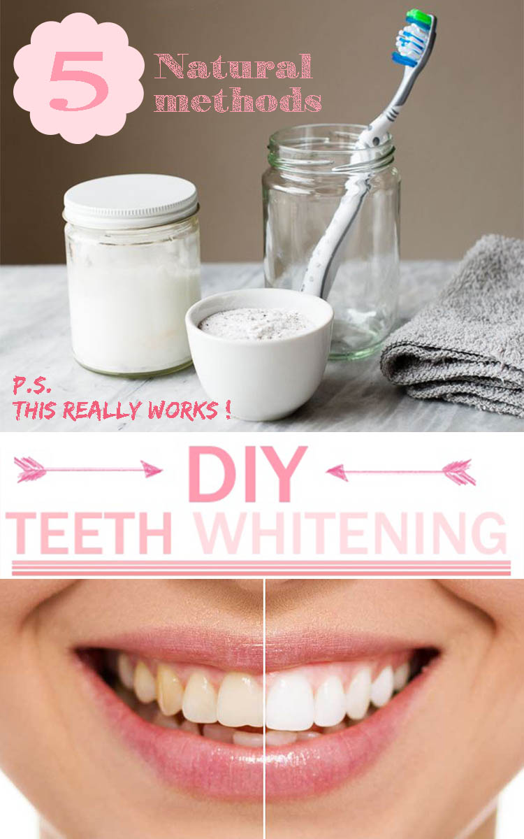 5 Natural teeth whitening methods