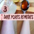3 Homemade Remedies for Dark Pores2