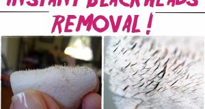 Say goodbye blackheads in 15 minutes !
