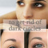 Top 3 remedies to get rid of dark circles under eyes